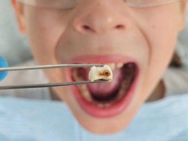 Best Emergency Pediatric Dentist  in Ferndale, MI